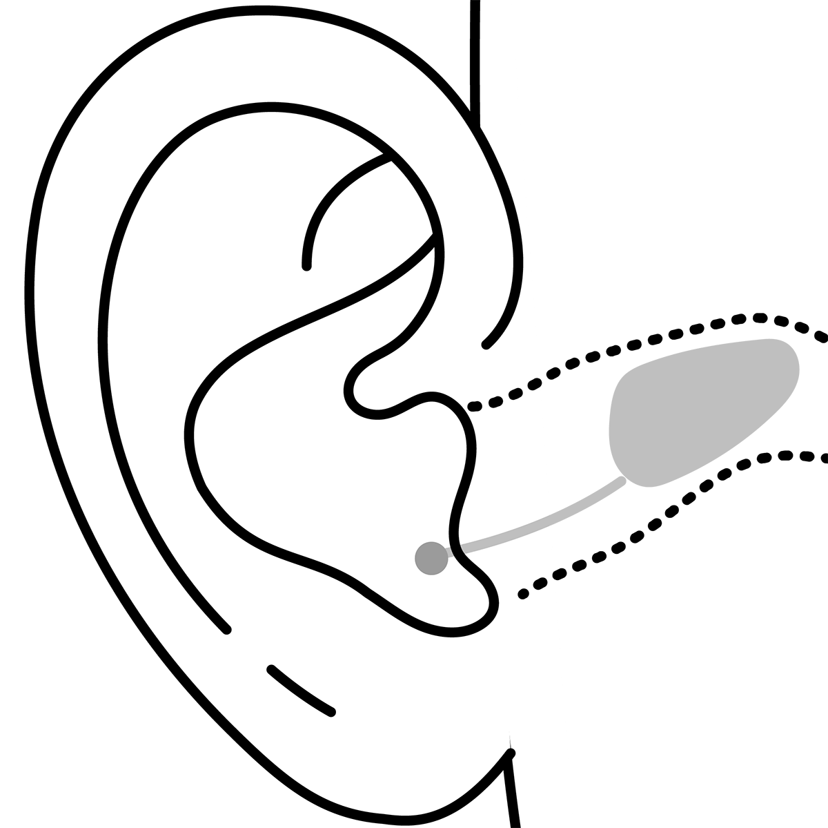 Invisible-in-Canal Hearing aids